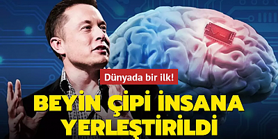 Dünyada bir ilk! Beyin çipi insana yerleştirildi