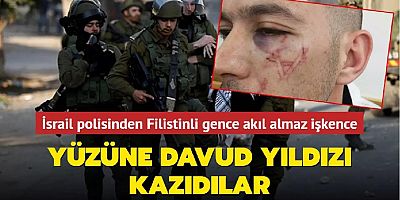 İsrail polisinden Filistinli gence akıl almaz işkence... Yüzüne Davud Yıldızı kazıdılar