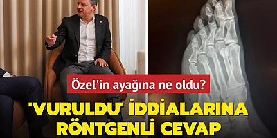 Özgür Özel'den 'vuruldu' iddialarına röntgenli cevap